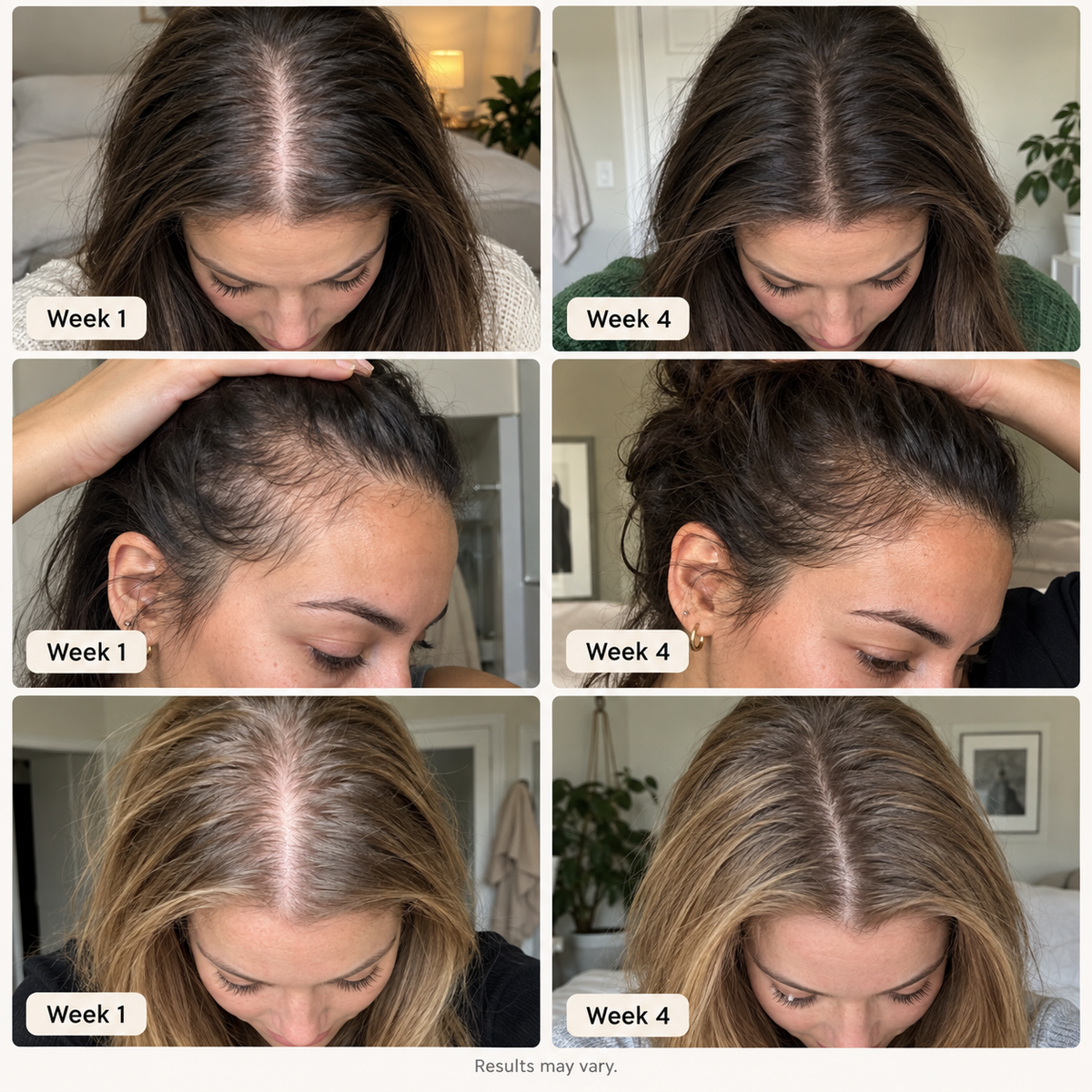 SORLI precision scalp serum bottle and applicator product detail